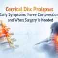 Cervical Disc Prolapse: Early Symptoms, Nerve Compression, and When Surgery Is Needed